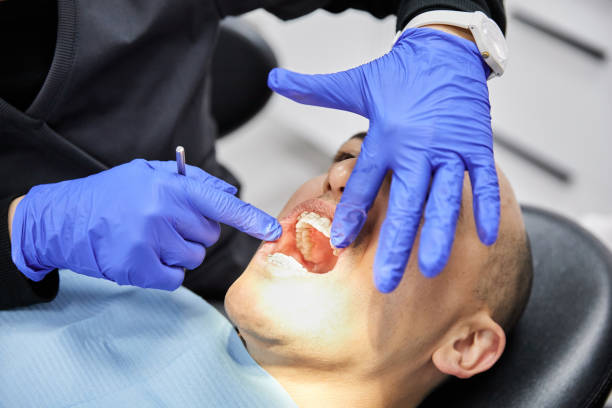 Best Emergency Dentist for Lost Fillings or Crowns in Carbon Hill, AL